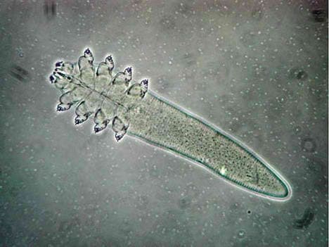 Mikroskopinis Demodex folliculorum erkutės vaizdas, kuri gali sukelti odos demodekozę ir vokų uždegimą.